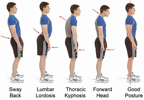 Types of posture